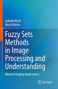 Fuzzy Sets Methods in Image Processing and Understanding