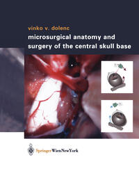 Microsurgical Anatomy and Surgery of the Central Skull Base