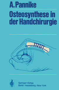 Osteosynthese in der Handchirurgie