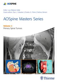 AOSpine Masters Series Volume 2: Primary Spinal Tumors