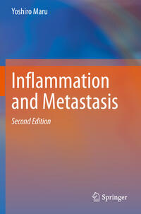 Inflammation and Metastasis