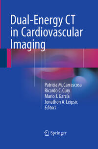 Dual-Energy CT in Cardiovascular Imaging