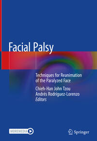 Facial Palsy