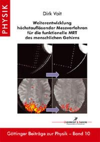 Weiterentwicklung höchstauflösender Messverfahren für die funktionelle MRT des menschlichen Gehirns