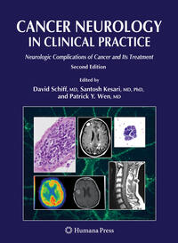 Cancer Neurology in Clinical Practice