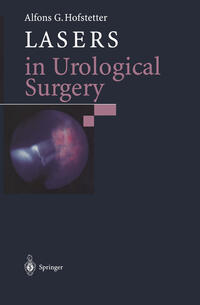 Lasers in Urological Surgery