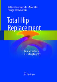 Total Hip Replacement