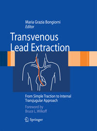 Transvenous Lead Extraction