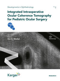 Integrated Intraoperative Ocular Coherence Tomography for Pediatric Ocular Surgery