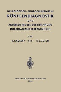 Neurologisch-Neurochirurgische Röntgendiagnostik und Andere Methoden zur Erkennung Intrakranialer Erkrankungen