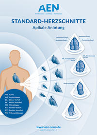 Standard-Herzschnitte Echokardiografie