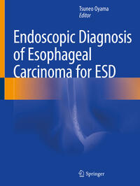 Endoscopic Diagnosis of Esophageal Carcinoma for ESD