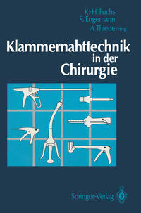 Klammernahttechnik in der Chirurgie