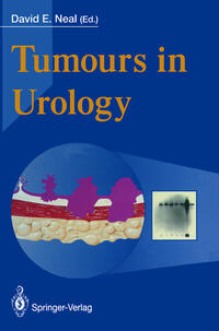 Tumours in Urology