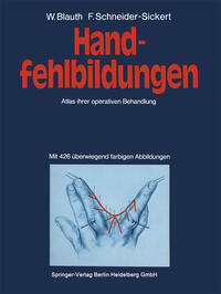 Handfehlbildungen