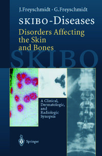 SKIBO-Diseases Disorders Affecting the Skin and Bones