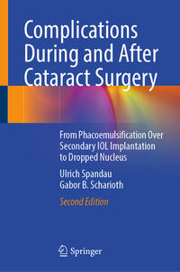 Complications During and After Cataract Surgery