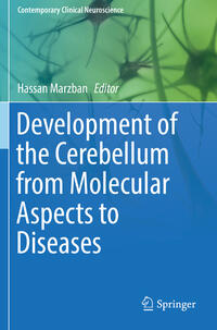 Development of the Cerebellum from Molecular Aspects to Diseases