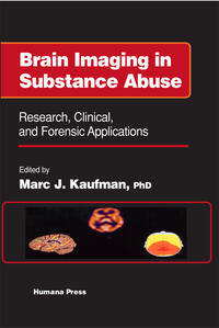 Brain Imaging in Substance Abuse