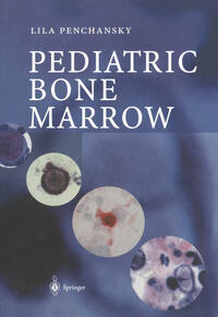 Pediatric Bone Marrow