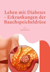 Leben mit Diabetes - Erkrankungen der Bauchspeicheldrüse