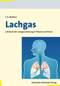 Lachgas