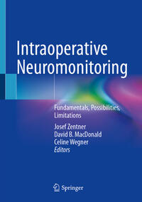 Intraoperative Neuromonitoring