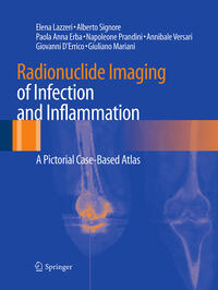 Radionuclide Imaging of Infection and Inflammation