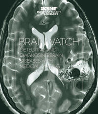 Brainwatch