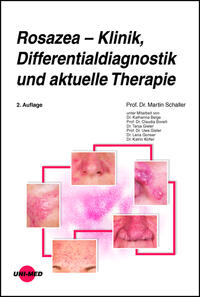 Rosazea – Klinik, Differentialdiagnostik und aktuelle Therapie