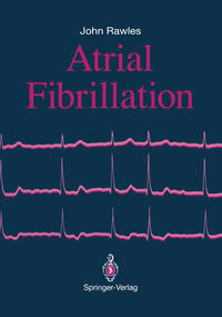 Atrial Fibrillation