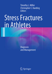 Stress Fractures in Athletes