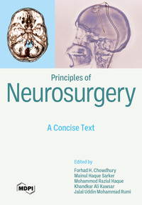 Principles of Neurosurgery