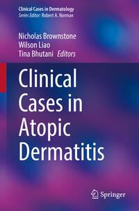 Clinical Cases in Atopic Dermatitis