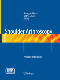 Shoulder Arthroscopy