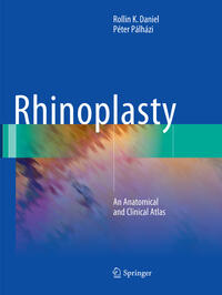 Rhinoplasty