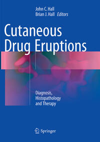 Cutaneous Drug Eruptions