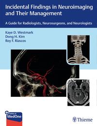 Incidental Findings in Neuroimaging and Their Management