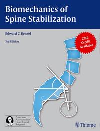 Biomechanics of Spine Stabilization