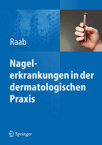 Nagelerkrankungen in der dermatologischen Praxis