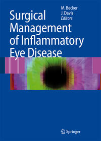 Surgical Management of Inflammatory Eye Disease