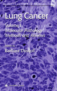 Lung Cancer