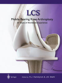 LCS® Mobile Bearing Knee Arthroplasty