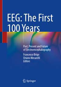 EEG: The First 100 Years