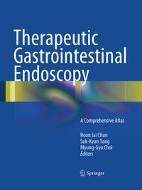 Therapeutic Gastrointestinal Endoscopy