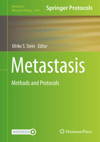 Metastasis