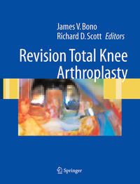 Revision Total Knee Arthroplasty