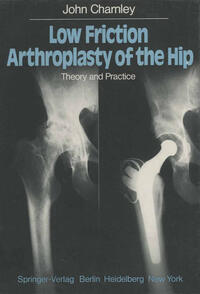 Low Friction Arthroplasty of the Hip