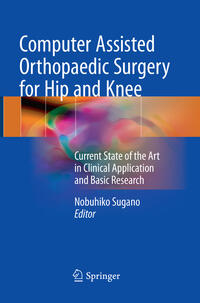 Computer Assisted Orthopaedic Surgery for Hip and Knee