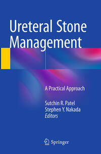 Ureteral Stone Management